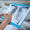 Chest X-Ray Based Cases Zeichen